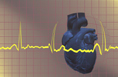 心脏移植术图解